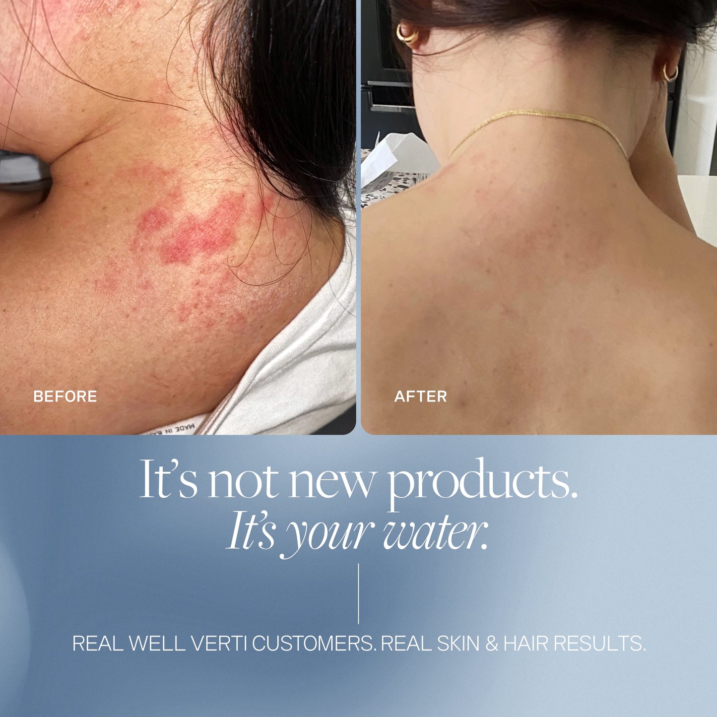 Wellness Pod ™ Shower Filter