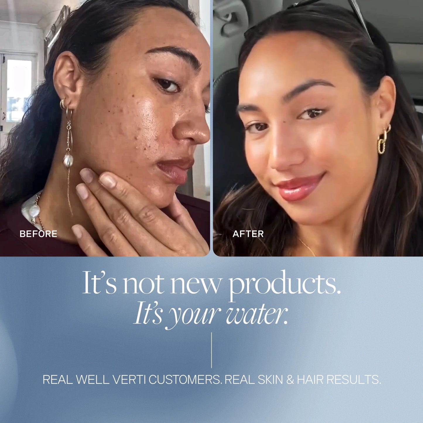 Wellness Pod ™ Shower Filter