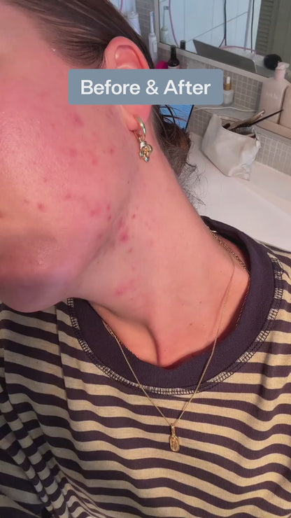 Wellness Pod ™ Shower Filter